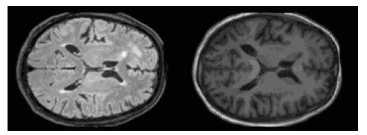 T1-weighted brain image 