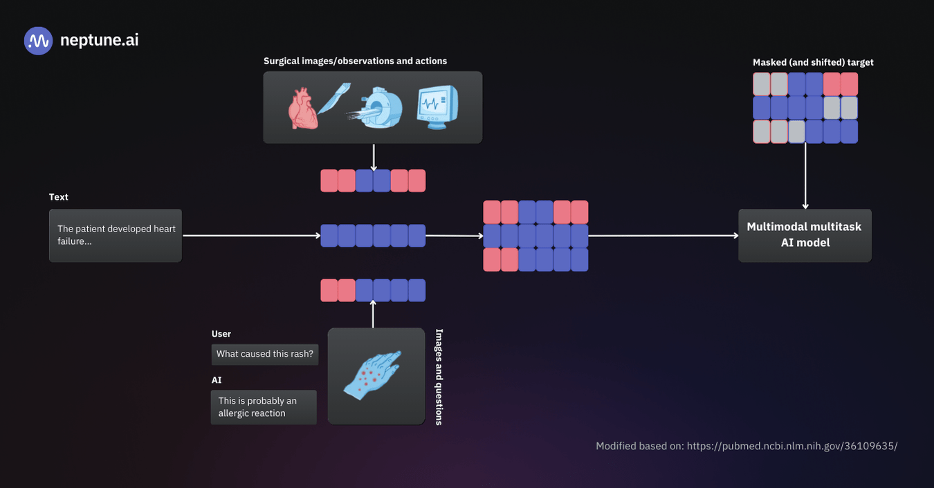 Example of a multi-modal model. The model is trained on X-rays, medical reports, actions, and texts describing the diagnosis and outcome. This way, the model learns to use visual and textual information to predict potential diagnoses. 